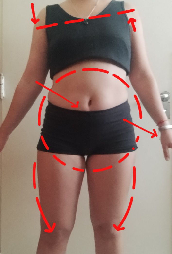 Lucas Castro - Antes